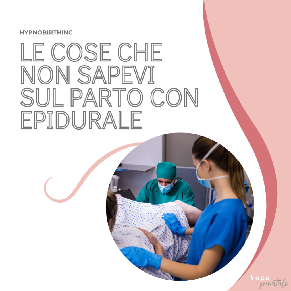 Le cose che non sapevi sul parto con epidurale